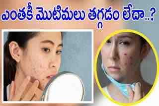 How To Solve Pimple Problem