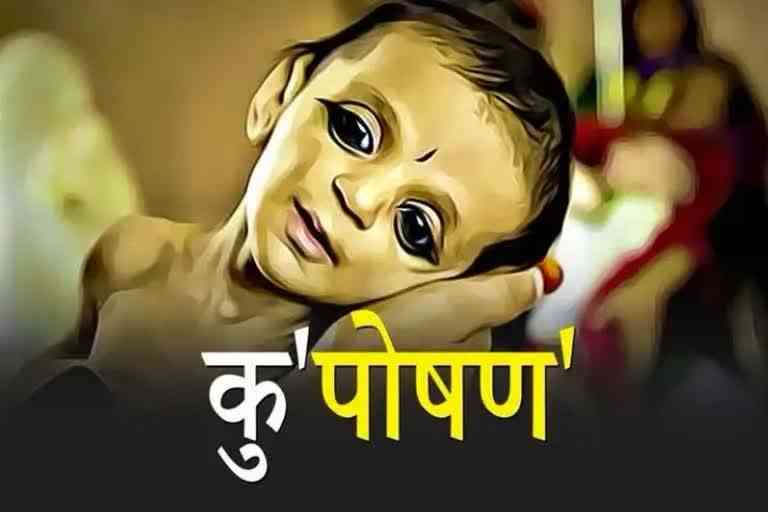 Malnourished girl died in Sheopur MP
