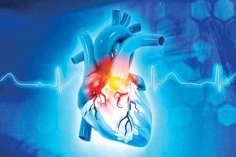 heart disease minor symptoms how to prevent cardiac arrest on world heart day 2022